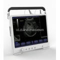 Portable Ultrasound Scanner Digital Ultrasound Machine Harga